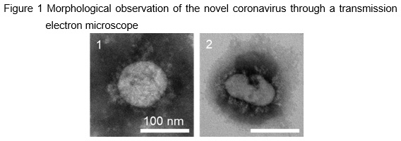 image:Figure 1 Morphological observation of the novel coronavirus through a transmission electron microscope