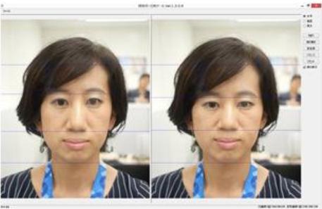 image: Analyzing facial balance