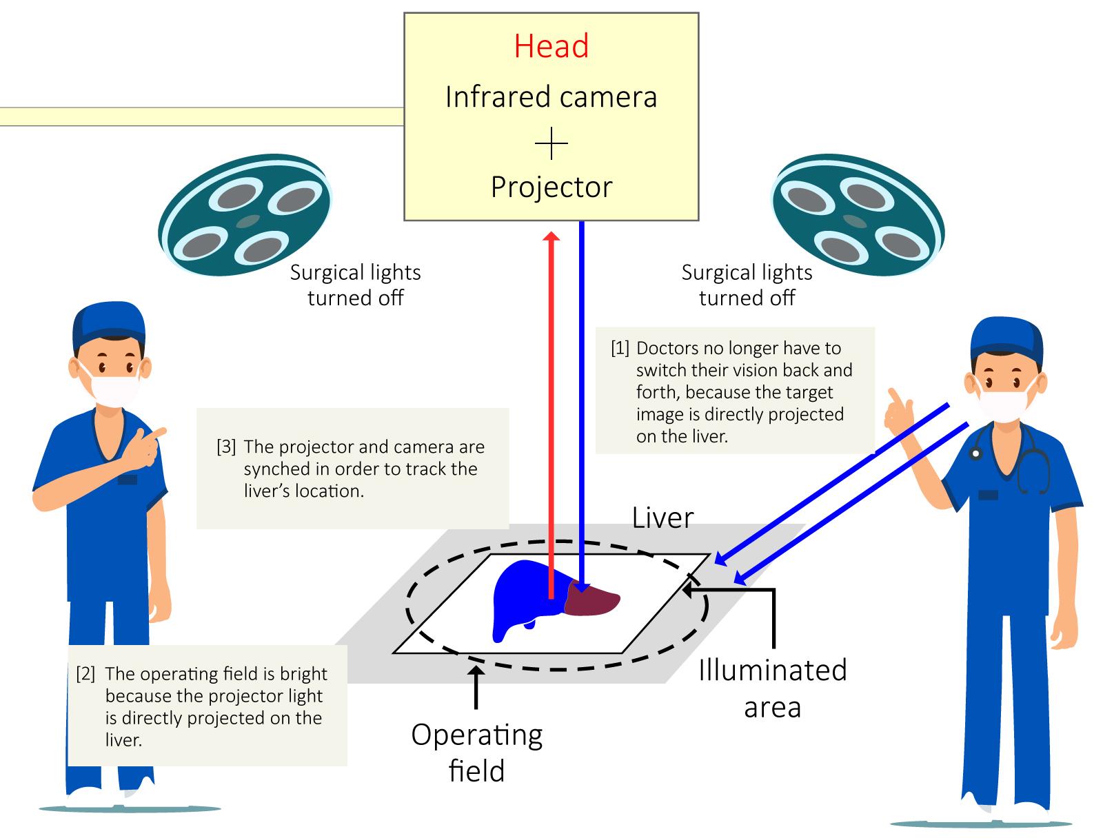 image: Liver surgery using MIPS jointly developed by Kyoto University and Panasonic