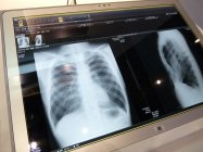 医療業界には、電子カルテや医療用画像ビューワーとしての用途を提案