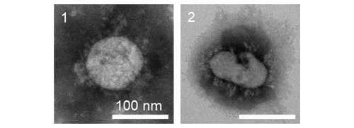画像：図1 透過型電子顕微鏡を用いた新型コロナウイルスの形態観察